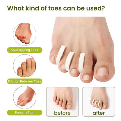 Bukihome 44-Pack Foam Toe Separators
