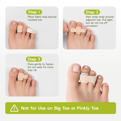 Bukihome Hammertoe Corrector