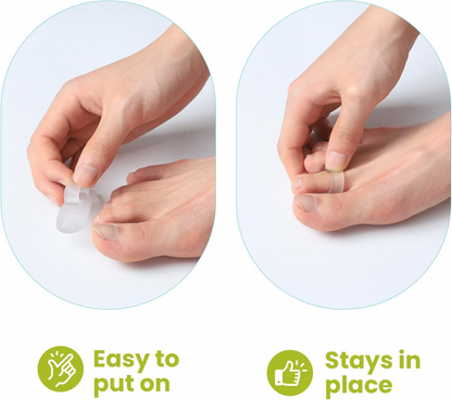 Bukihome Hammertoe Straighteners