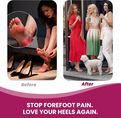 Bukihome Soft Gel Metatarsal Pads