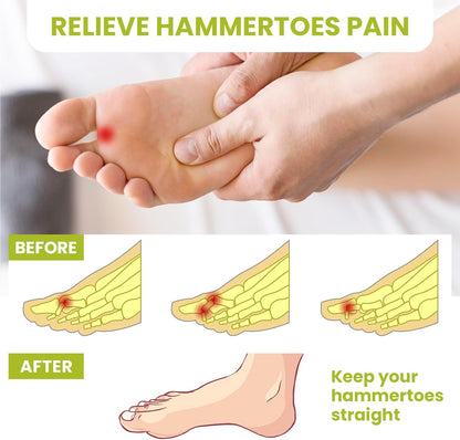 Bukihome Hammertoe Corrector
