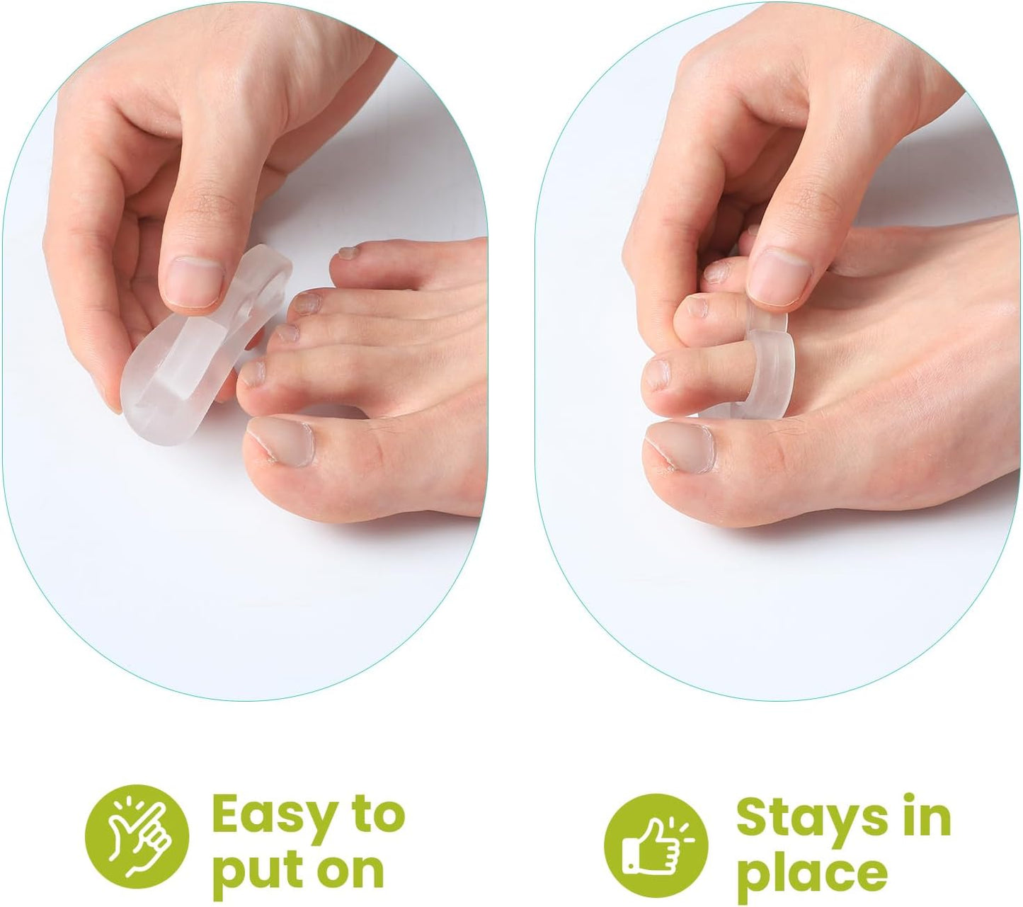 Bukihome Hammertoe Corrector