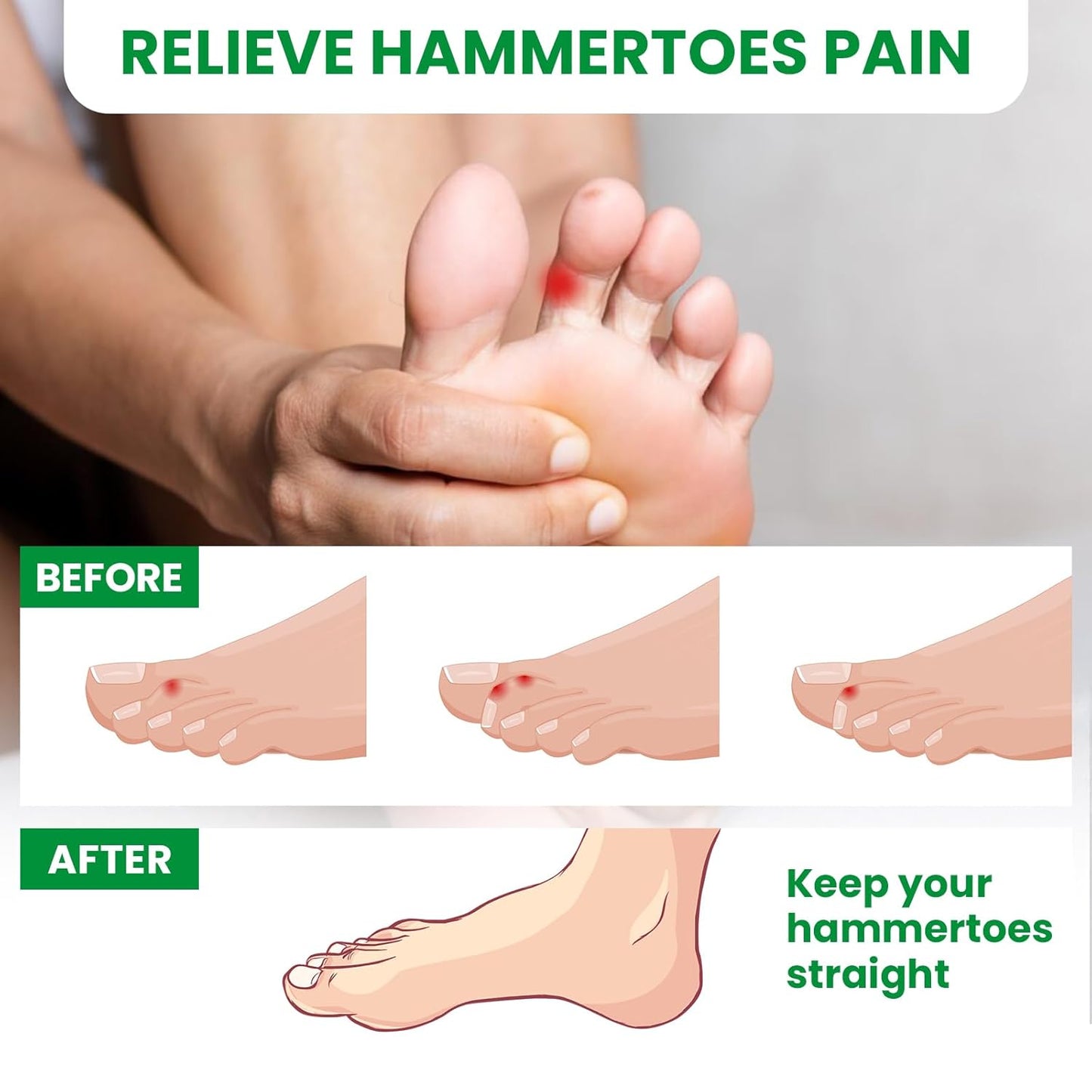 Bukihome Hammertoe Corrector Toe Wrap