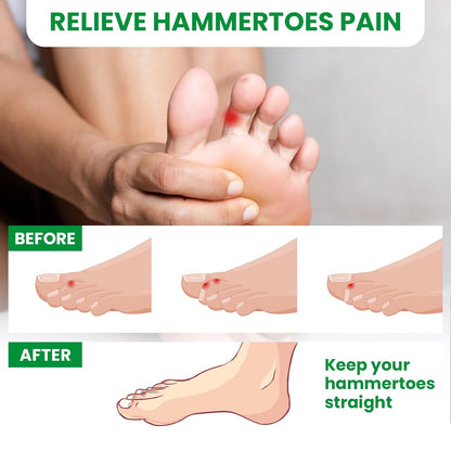 Bukihome Hammertoe Corrector Toe Wrap