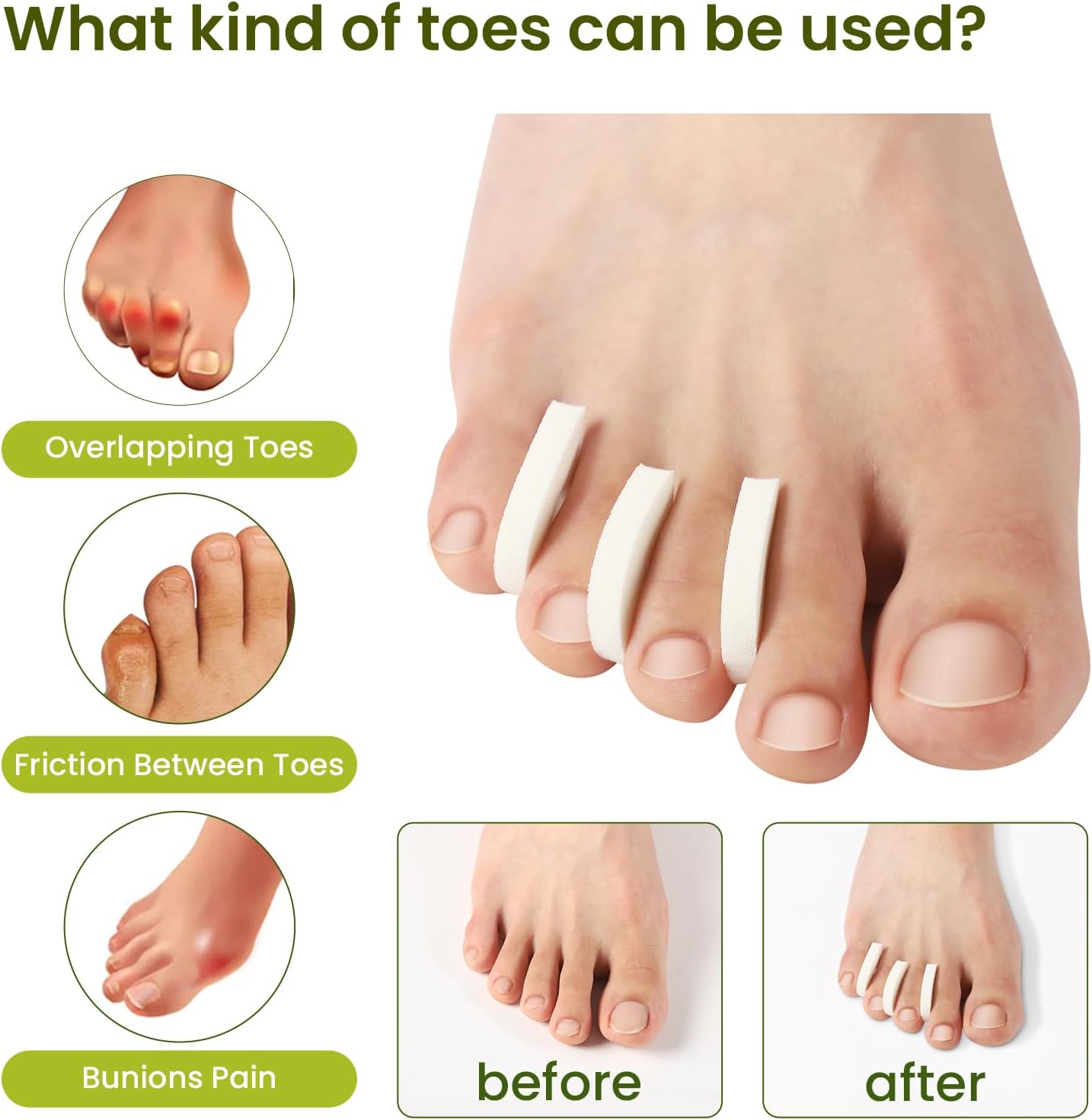 Bukihome Foam Toe Separators